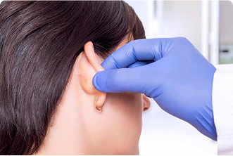 Ear Reconstruction
