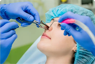 Rhinoplasty (Nose Surgery)